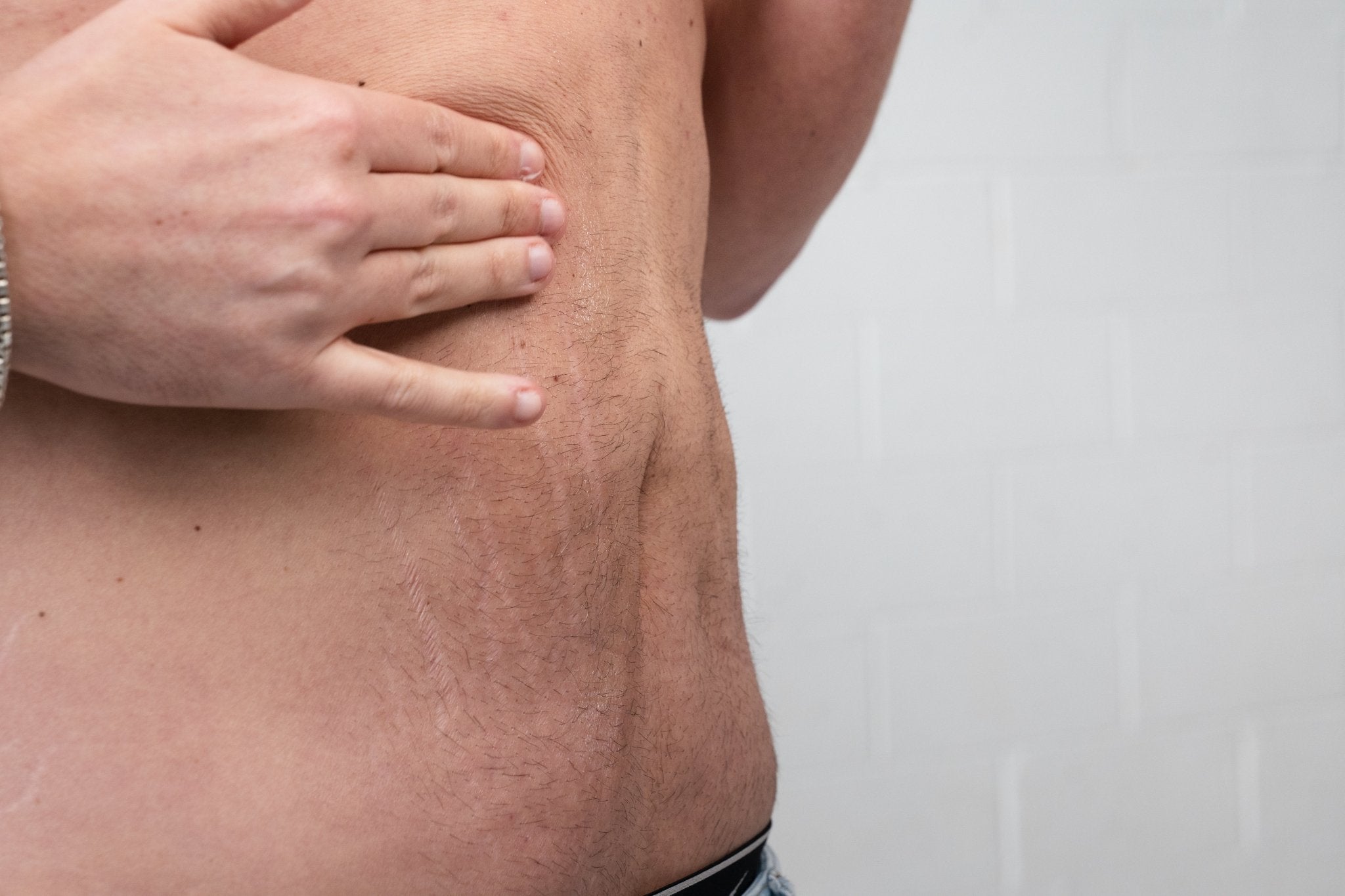HOW TO FIRM SKIN AFTER WEIGHT LOSS ON GLP-1: WHAT ACTUALLY WORKS - ElastiK° Skin