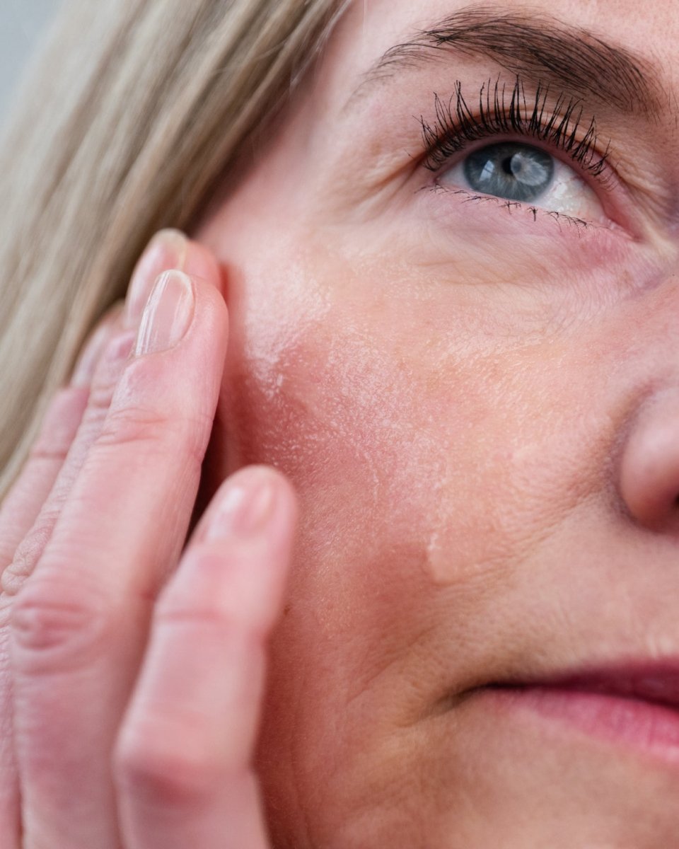 HYDRATION CONTINUUM GEL | For GLP - 1, Weight Loss, Ageing, Hormonal & Postpartum Skin - ElastiK° Skin