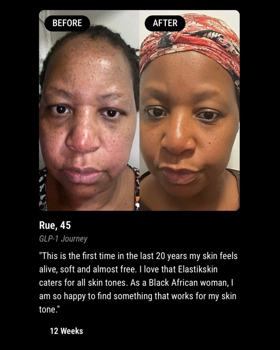 RESILIENCE MATRIX NIGHT CREAM | For GLP - 1, Weight Loss, Ageing & Postpartum Skin - ElastiK° Skin