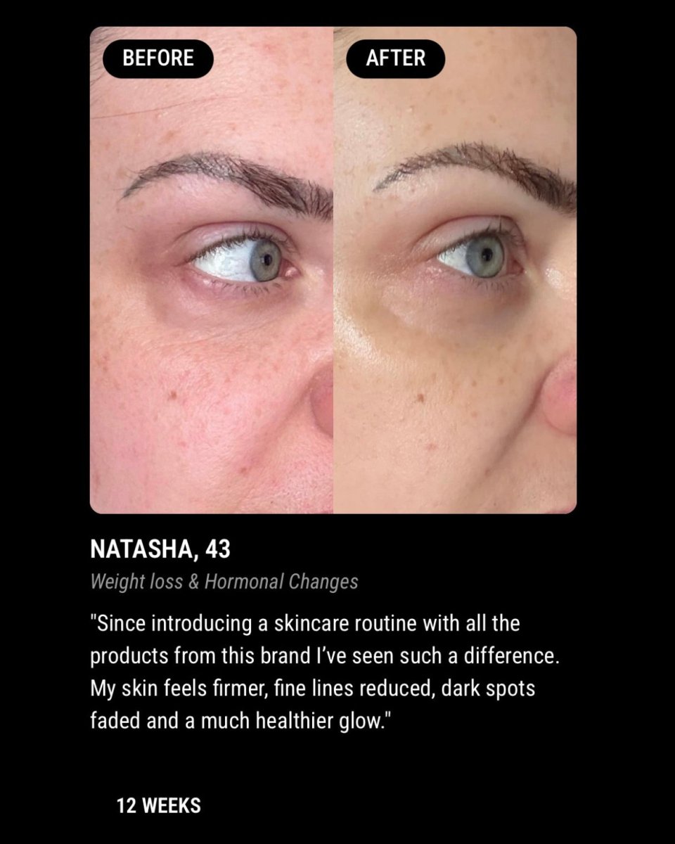 RESILIENCE MATRIX NIGHT CREAM | For GLP - 1, Weight Loss, Ageing & Postpartum Skin - ElastiK° Skin